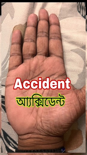 আ্যক্সিডেন্টের যোগ। #astrology #জ্যোতিষ #palmistry #হস্তরেখা #হস্তরেখাবিদ্যা