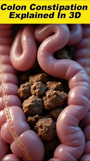 What Happens Inside Your Colon