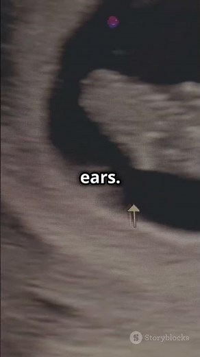 Week 6 of Pregnancy: Your Baby's Facial Features Begin to Form