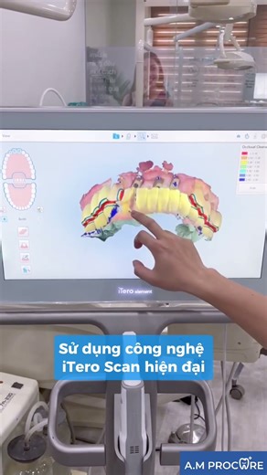 Implant Scan Body & iTero 5D – Cách mạng trong implant kỹ thuật số | Nha khoa AM Procare