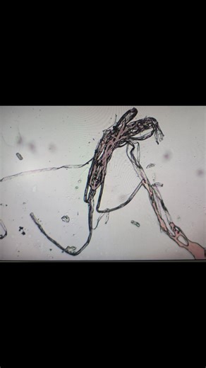Todays lineup of nasty guys found in 1 drop of blood 👀👀🤔🤔😕😕 Shown under both Darkfield and Brightfield microscopy... #healthylifestyle #health #Australia #detox #spirituality