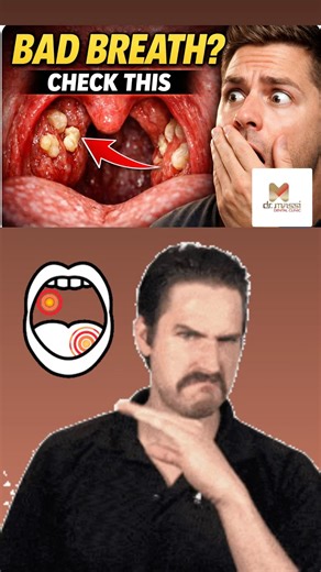 Why Your Mouth Smells Disgusting 🤢demo educational