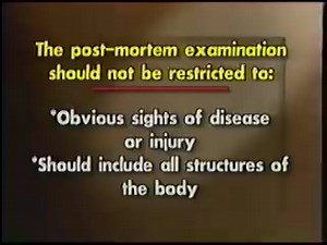THE AUTOPSY PROCEDURE 1961 : PARAMEDIA VIDEO : Free Download, Borrow, and Streaming : Internet Archive