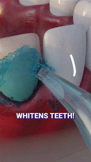 We Spent the Last Three Months Testing the 24 Water Flossers Devices to Find the Best 5 Water Flossers in 2025. We rated the best five options based on ✅ Best Results ✅ Safe for At-Home Use ✅ Cost Effective ✅ 100% Money Back | Water Flosser | Facebook