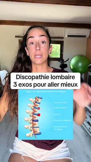 Exercices pour Soulager la Discopathie Lombaire