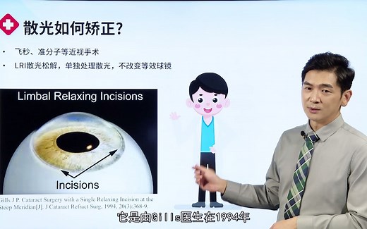 LRI散光松解的操作和技术要点-1