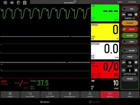 Pulseless Ventricular Tachycardia with Defibrillation