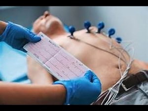 What Is an Electrocardiogram (ECG)? How It Works and What It Shows