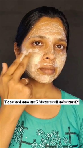 फेस वरचे काळे डाग 7 दिवसांत कमी कशे करायचे #1million #haircare #growth #hairgrowth #longhair #hair
