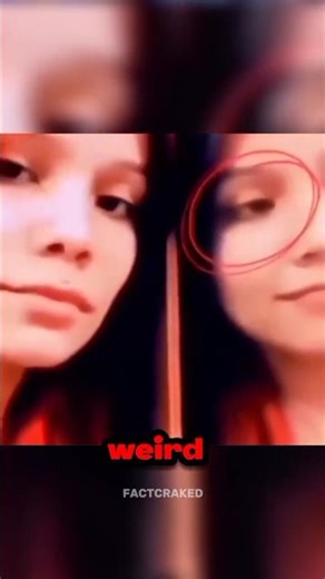 Mirror Test… Why One Eye Won’t Move 😳 #shorts