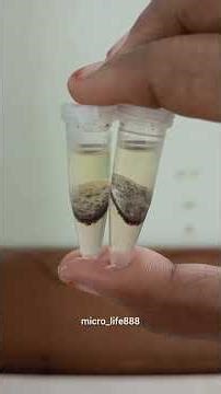 🧬🧪 #isolation#DNA #BiotechLife#StudentLife #ScienceReels #ResearchLife #LabVibes #ScienceStudents