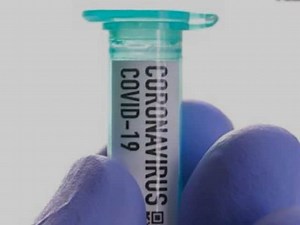 COVID-19 Pandemic: What Is Herd Immunity?