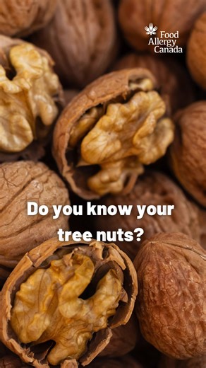 Do you know your tree nuts? 👀 Watch until the end to find out... it’s walnuts! ⭐️It's important to recognize the differences between various tree nuts, as some people with a tree nut allergy may be allergic to more than one type of tree nut. While others may only be allergic to one type of tree nut. #SeeItKnowIt #MoreThanPeanuts #FoodAllergyAwareness #TreeNutAllergy #NutAllergy #Walnut #Walnuts | Food Allergy Canada