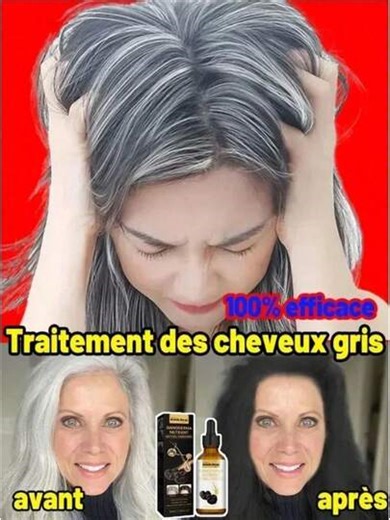 2026 White Hair To Black Hai - Natural Grey Hair Care For Men And Women, Removes White Hair, Quick Results In 7 Days | SHEIN