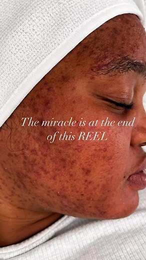 Skin Soma Aesthetics on TikTok