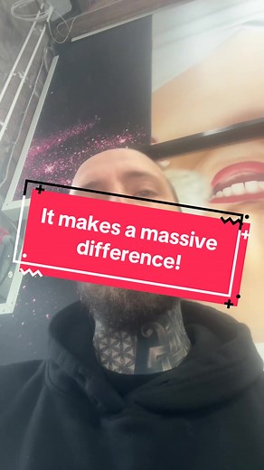 I never realised how bad the front camera quality was compared to the back until I started using it! #contentcreator #ninjaview #mirrorselfie #tiktokshopaffiliate #fyp