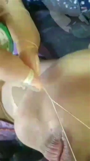 upper lips kaise kare , upperlips thread