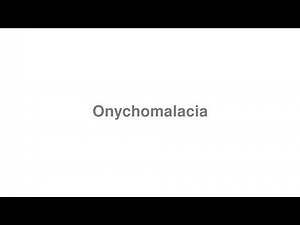 How to Pronounce "Onychomalacia"