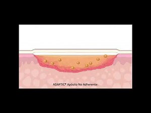 ADAPTIC Apósito No Adherente Cómo funciona