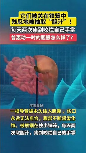 它們被關在鐵籠中，殘忍地被抽取“膽汁”！#活熊取膽 #保護動物 #上熱門 #社會百態 #冷知識科普