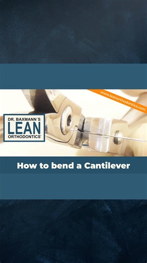How to bend a Cantilever 👉 Gain valuable insights and practical tips in this short, easy-to-follow Powerwebinar. Based on feedback from my students, I've created this series of free webinars featuring concise, focused videos. I hope you enjoy this one! 👍 Like, share, and comment to stay updated for more! | Dr. Baxmann’s Lean Orthodontics