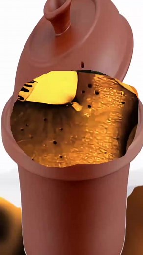 37K views · 329 reactions | “It’s not just a blackhead—it’s a mini volcano! Watch it erupt | Blackheads X Popping | Facebook