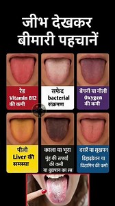जीभ देखकर पहचानें बीमारियाँ | Tongue Color से जानें सेहत के राज #shorts #shortsfeed #health #facts