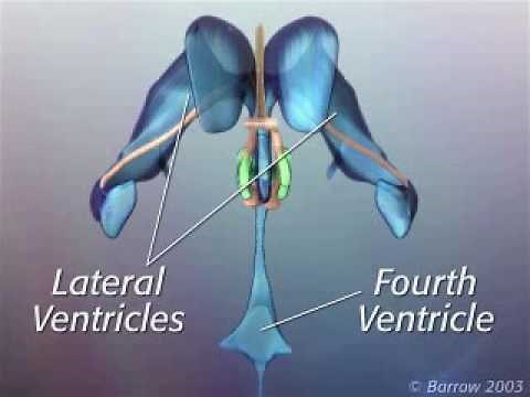 Anatomy of Hypothalamic Hamartoma