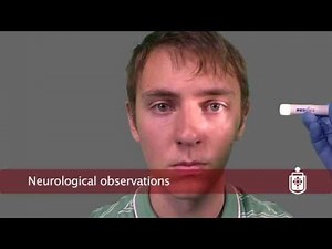Neurological Observations