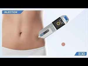 Flexi-Q eMU-C Dual Chamber Cartridge