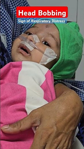Head Bobbing Sign of Respiratory Distress #neonatalresuscitation