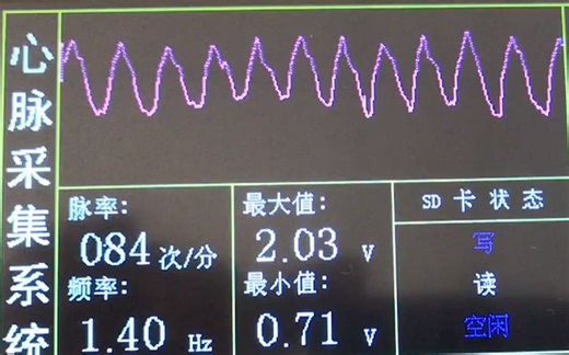 ［毕业设计］基于FPGA的心电脉搏信号采集系统