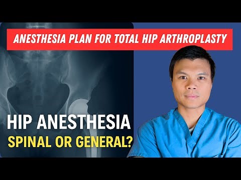 Anesthesia Plan for Total Hip Arthroplasty | CRNA Walkthrough
