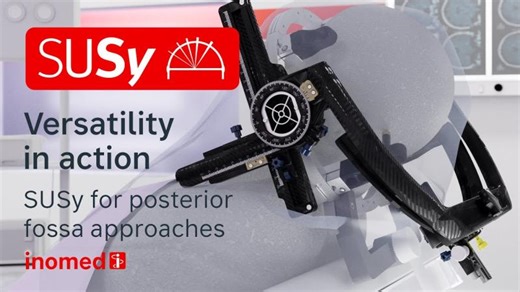 Versatility in action - SUSy for posterior fossa approaches - inomed | inomed