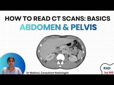 How to read CT(Basics): Abdomen/Pelvis