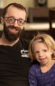 577K views · 602 shares | A five-year-old girl born with a rare craniofacial disorder is navigating the world with the help of her father, who was diagnosed with the same condition  | Born Different | Facebook