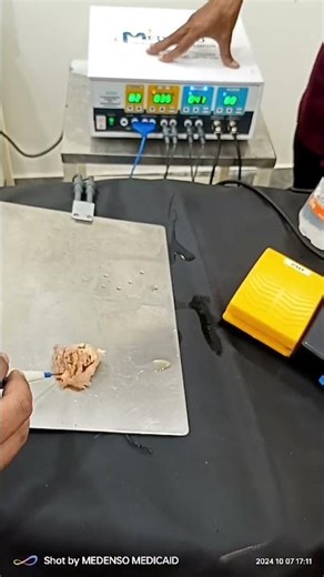 Medenso Medicaid | 400 W Cautery Machine Demo | Precision & Power in Every Cut