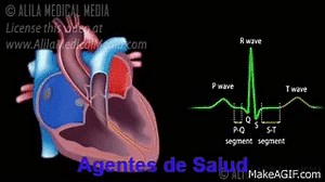 Cardiac Conduction System and Understanding ECG, Animation. on Make a GIF