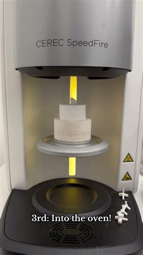 Watch a Same Day CEREC Crown Being Made 🦷 | Inside Dentique Dental North Sydney