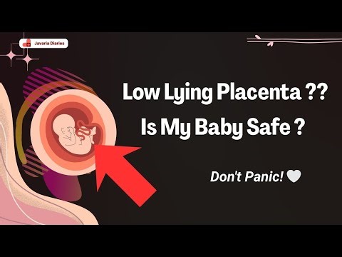 Low-Lying Placenta in Pregnancy | Causes, Symptoms & Precautions | Pregnancy Care