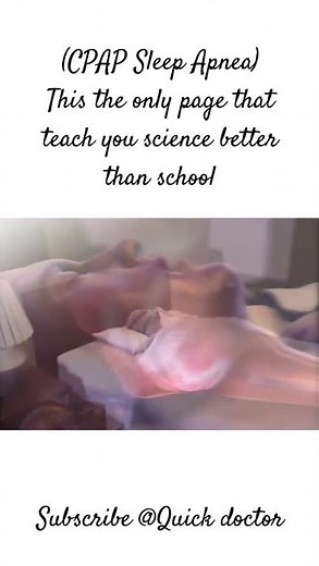 "Sleep Apnea Explained: The Science Behind CPAP Therapy" #viral #cpapmachine