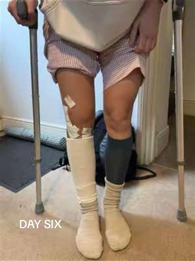 Supporting Lil Baby Quad Through ACL Recovery