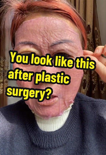 Dangers of Plastic Surgery: Real Transformations Reviewed