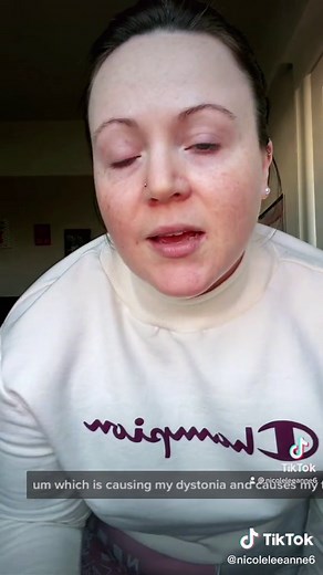 Deep brain stimulation in the treatment of my tremors. #RufflesOwnYourRidges