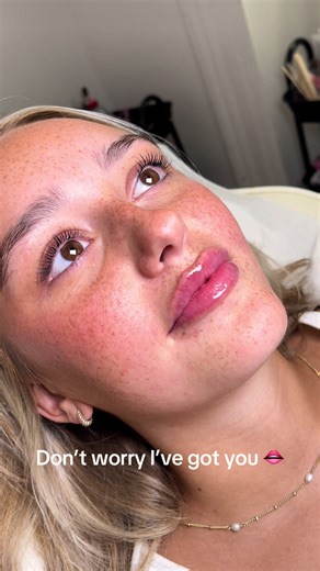 Achieve Natural-Looking Lips with Lip Filler Tips