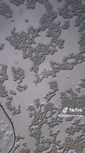 Exploring Blood Cells Under a Microscope