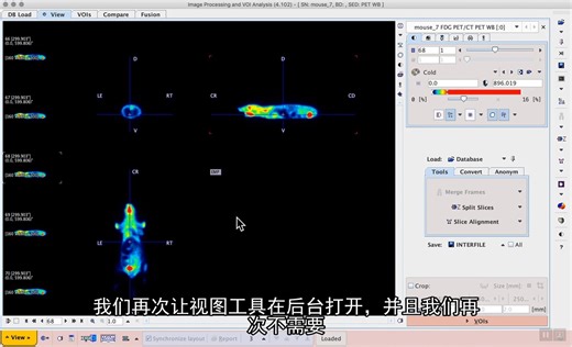 医学图像处理和分析软件 PMod（S1E3）：Loading images using AUTODETECT