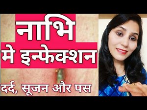 Home Remedies for Belly Button Infection || Simmi Makeover