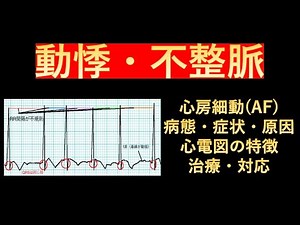 心房細動(AF)の病態・症状・原因、心電図の特徴と治療・対応