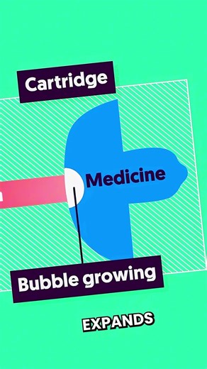 Why People Didn't Invent It Earlier